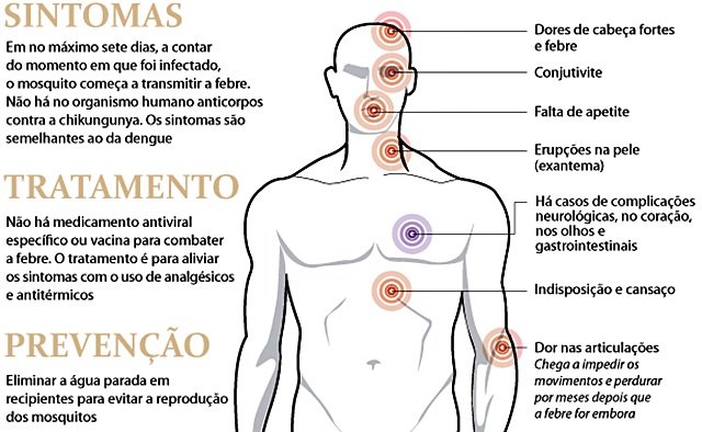 Resultado de imagem para CHICUNGUNHA